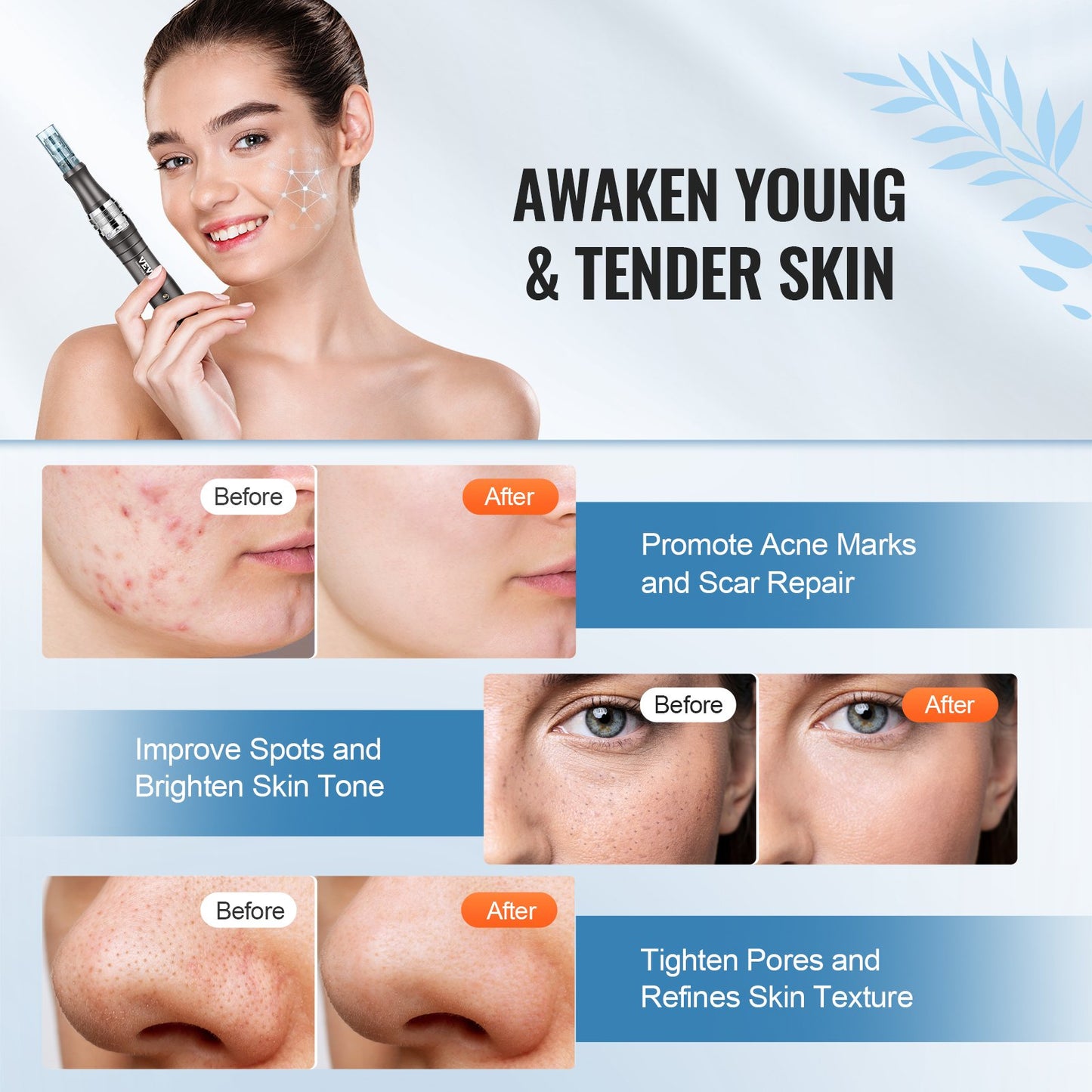 Professional Microneedling Pen 6-Speed Electric Beauty Pen med 6 nålar